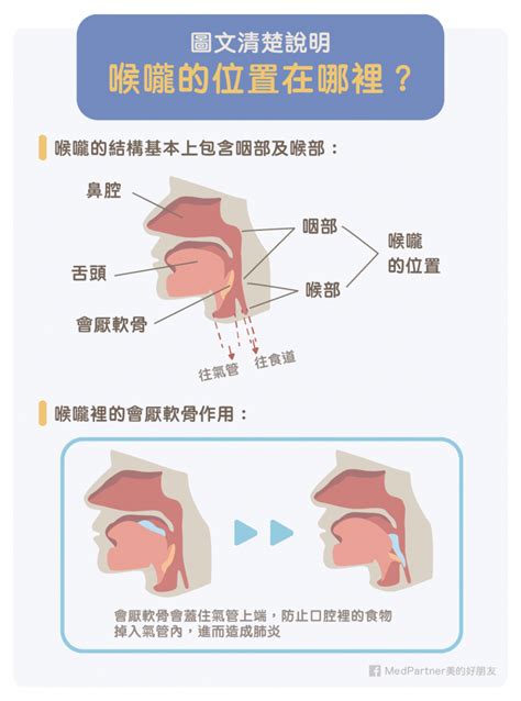 喉嚨長一顆痘痘|為什麼你的喉嚨卡卡不會好？慢性咽喉炎圖文懶人包一。